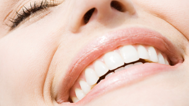 Teeth Whitening 19